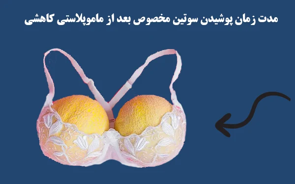 مدت زمان پوشیدن سوتین بعد ماموپلاستی کاهشی