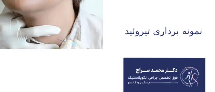 نمونه برداری تیروئید چه کاربری دارد؟