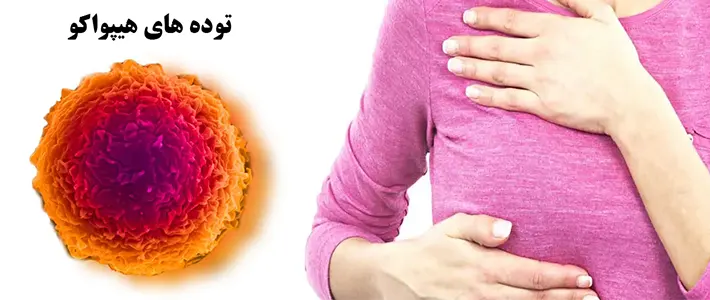 توده هیپواکو سینه