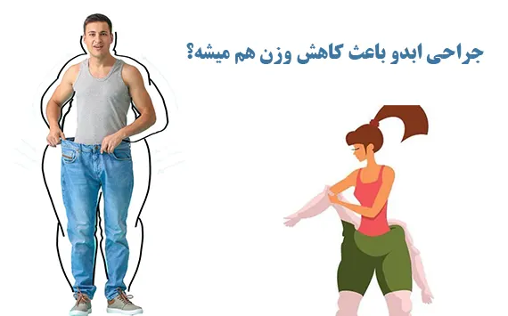 لاغری با جراحی ابدو