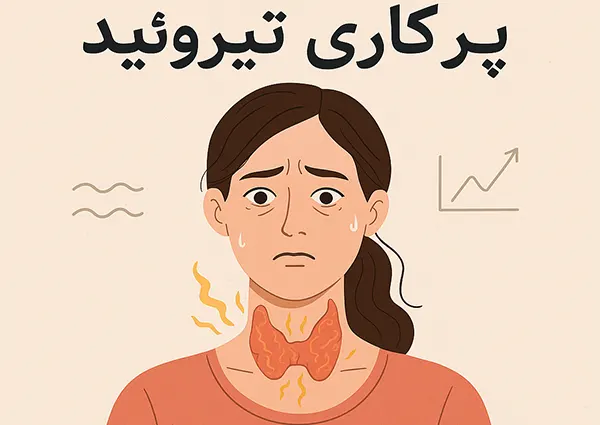 درمان پرکاری تیروئید