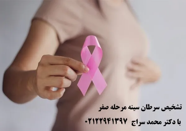 سرطان سینه مرحله صفر
