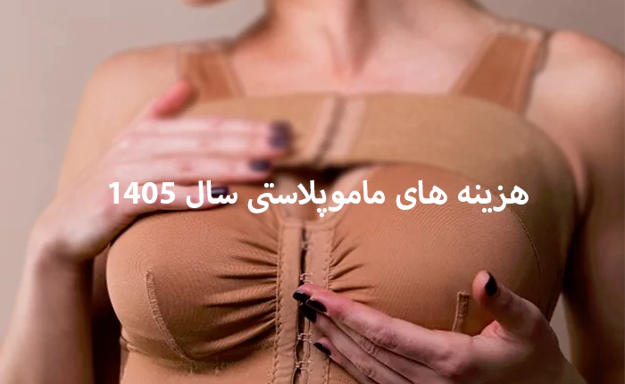 هزینه های ماموپلاستی سال 1405